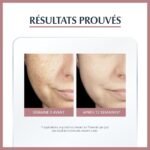 Eucerin ANTI-PIGMENT SÉRUM DUO 30 ML + Ecran pigment spf50 OFFERT – Image 4