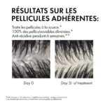 Vichy Dercos Shampoing Traitant Anti-Pelliculaire Cheveux Normaux à Gras | 200ml = Serviette Offerte – Image 9