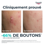 EUCERIN DERMOPURE TRIPLE ACTION SERUM – Image 5