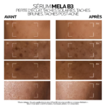 Routine Anti-Taches Mela B3 - Mela B3 Gel Micro-Peeling 200ml et Sérum Concentré Mela B3 50ml – Image 4